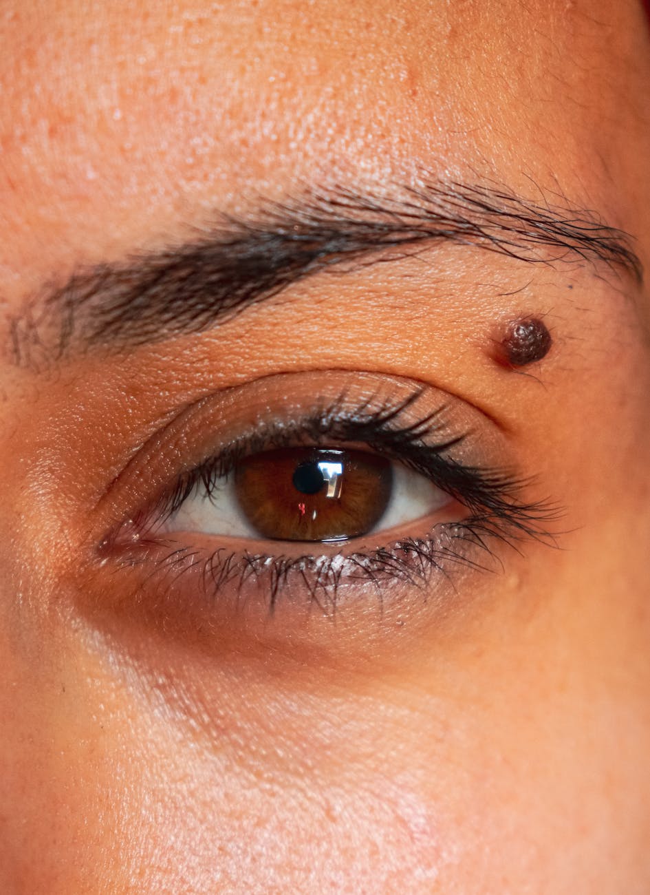 close up of brown eye with skin mole